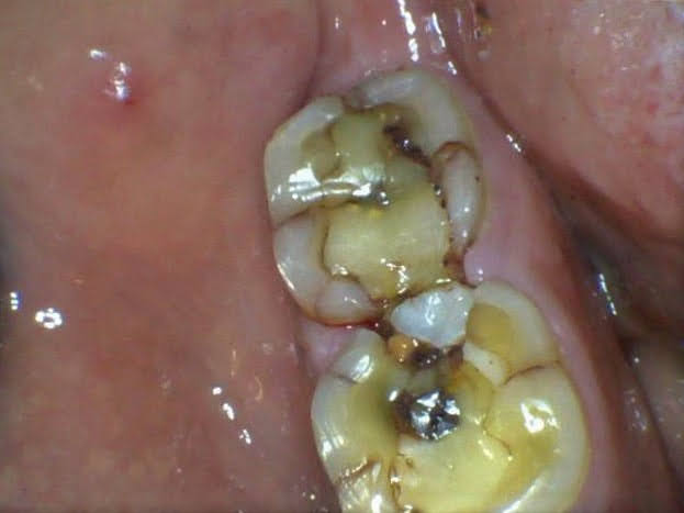 Dentist Near Me- Dr Ashish Shah"