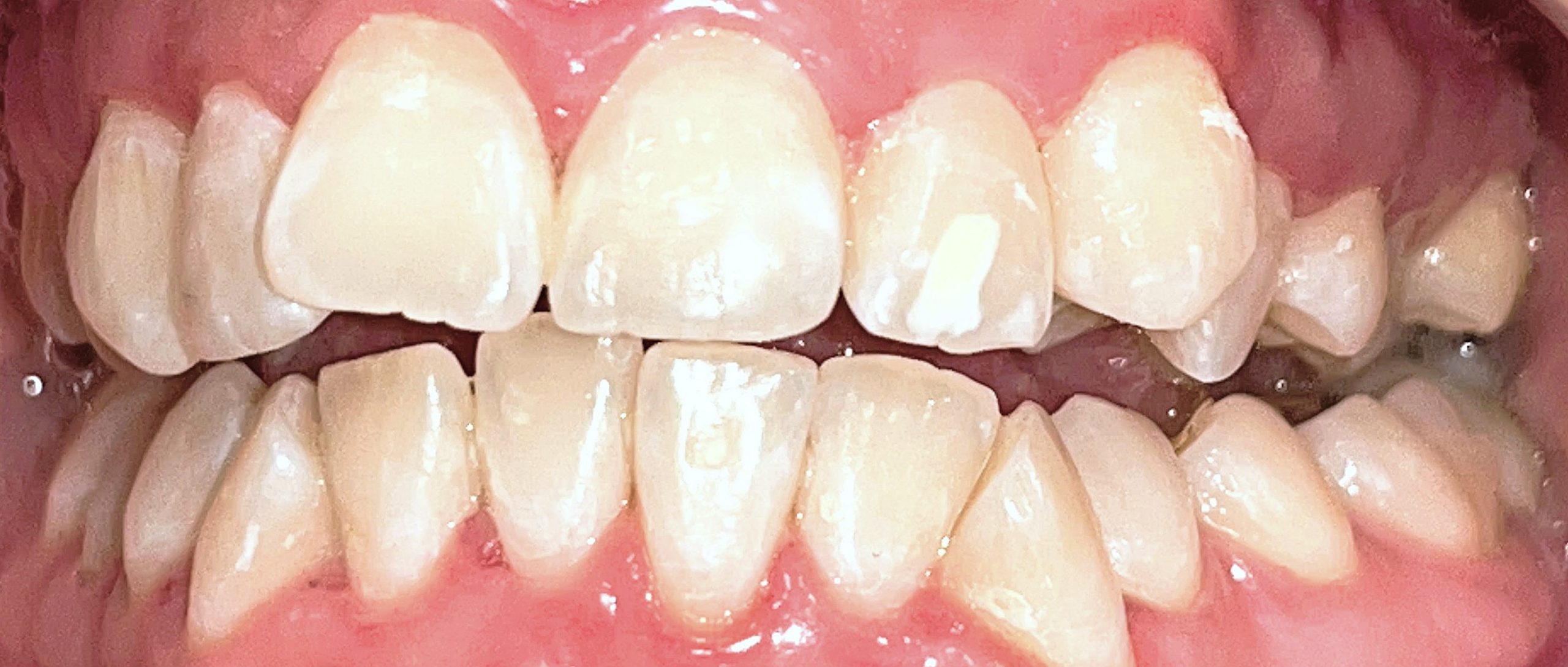 Best Dentist In Mumbai