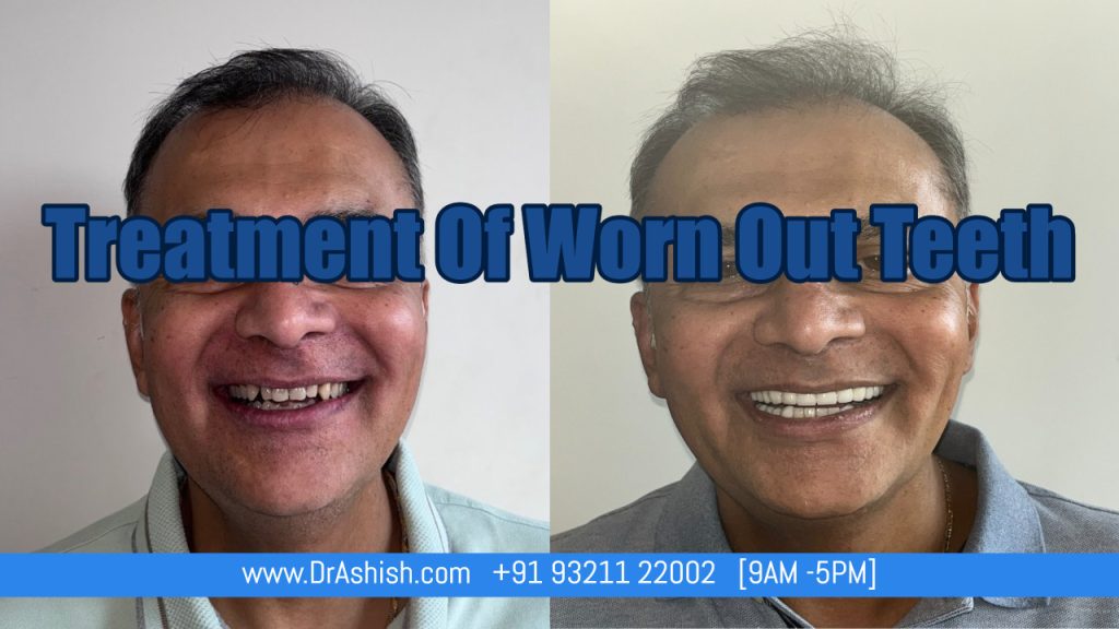 Dentist Near Me-Dr Ashish Shah