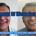Dentist Near Me-Dr Ashish Shah