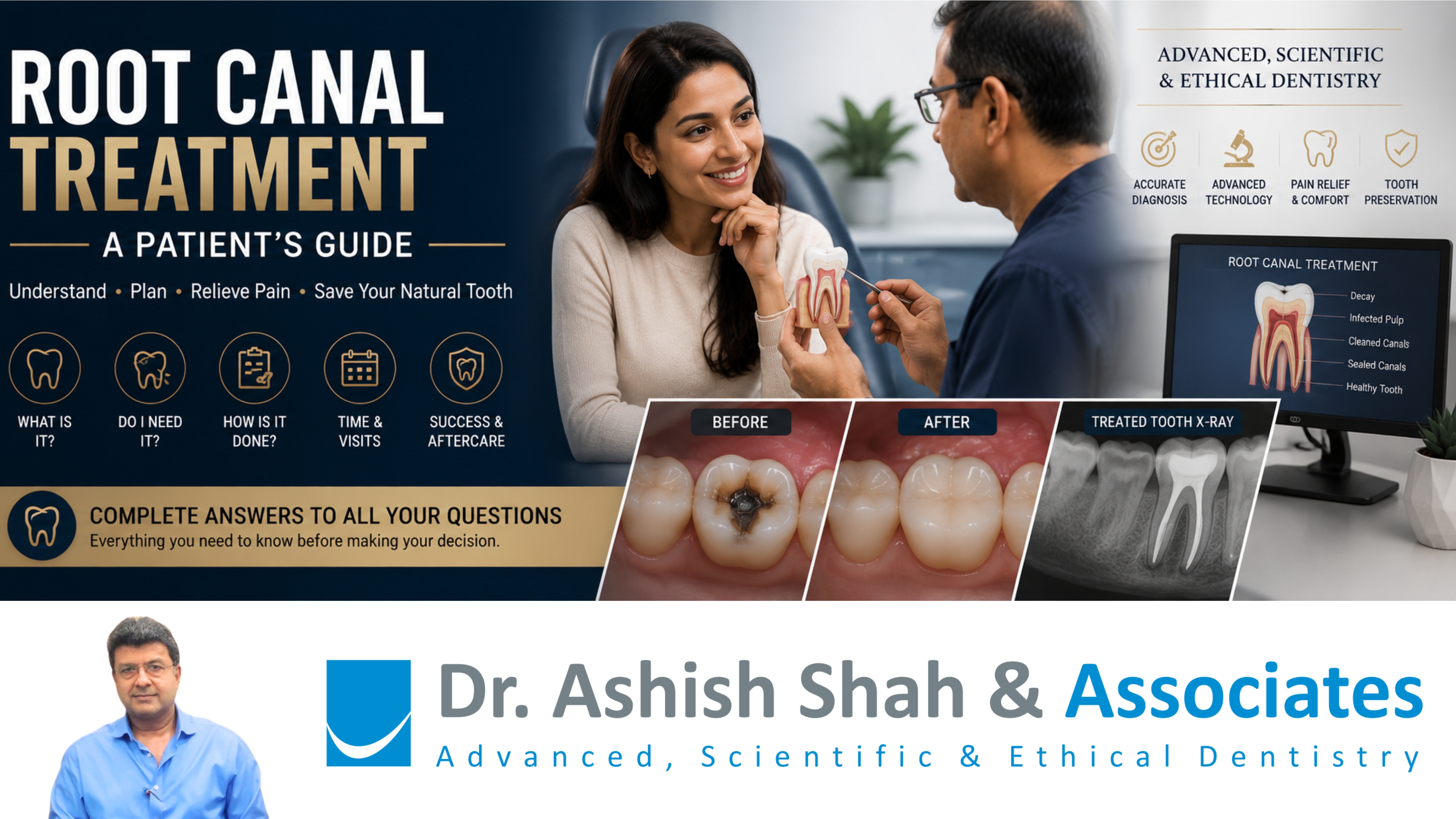 Root Canal Treatment- A Patient's Guide
