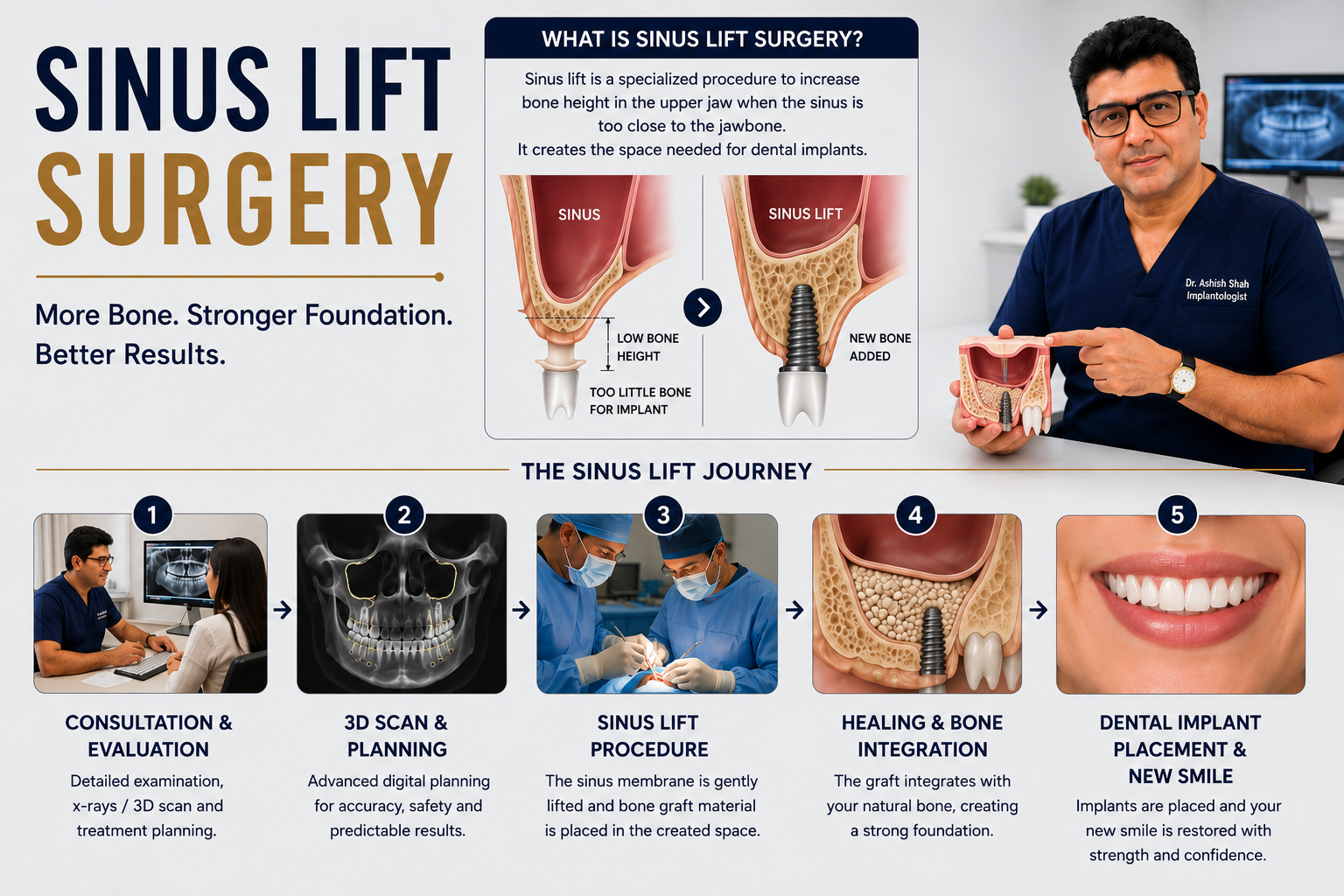 Sinus Lift Surgery