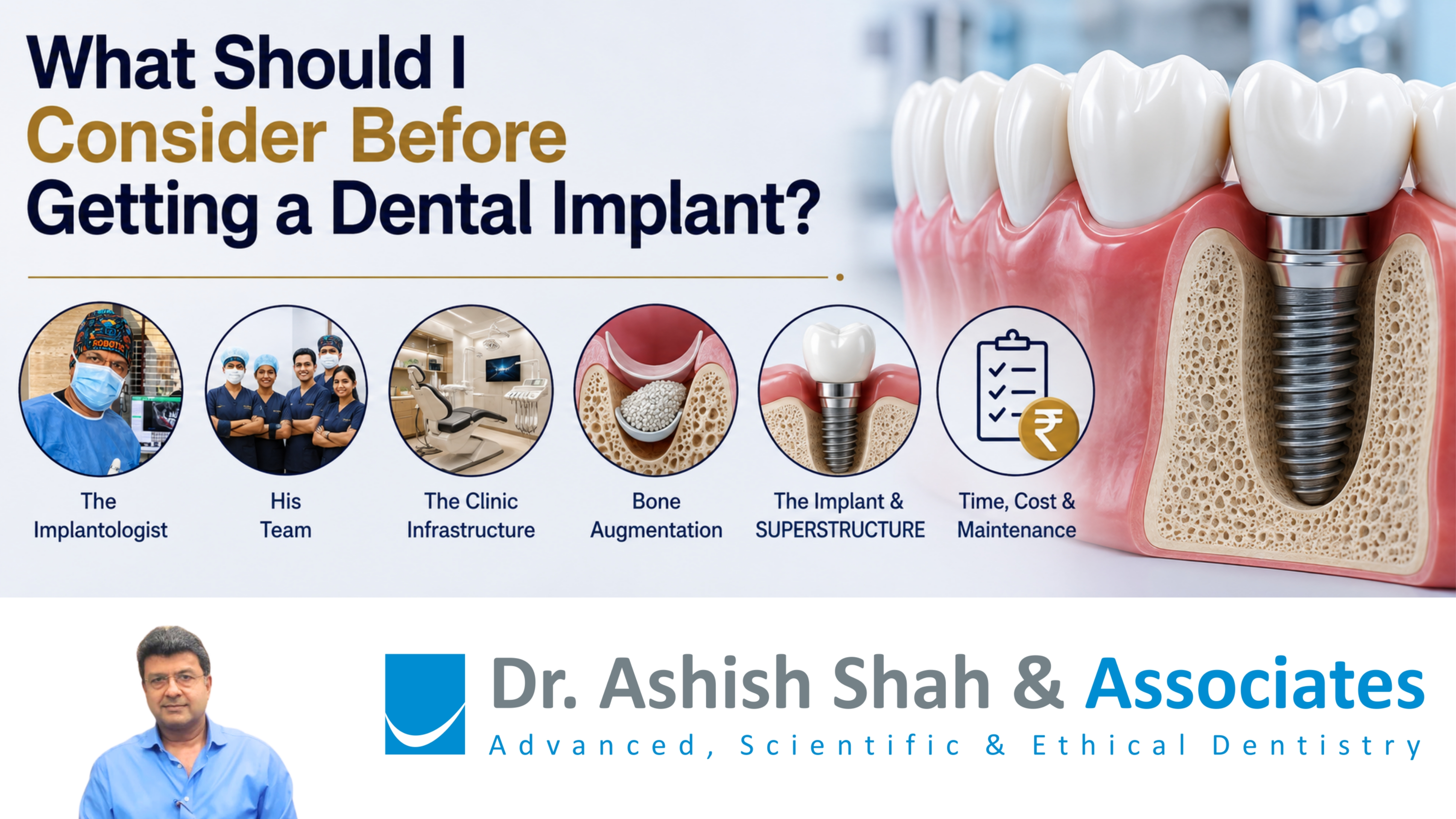 What Should I Consider Before Getting dental implants?